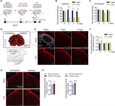 Phα1β Spider Toxin Reverses Glial Structural Plasticity Upon Peripheral Inflammation